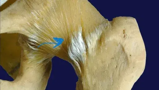 Role of the iliofemoral ligament in hip joint disease
